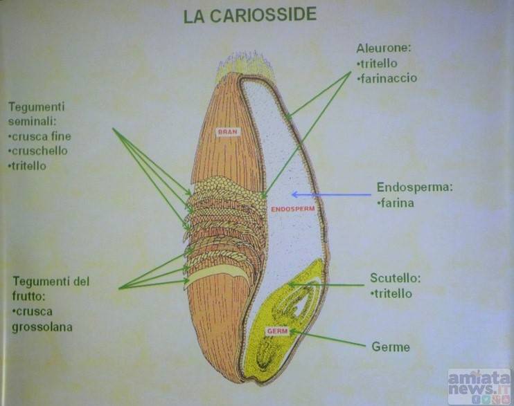 Diapositiva ripresa dallo studio del Prof. Bendettelli