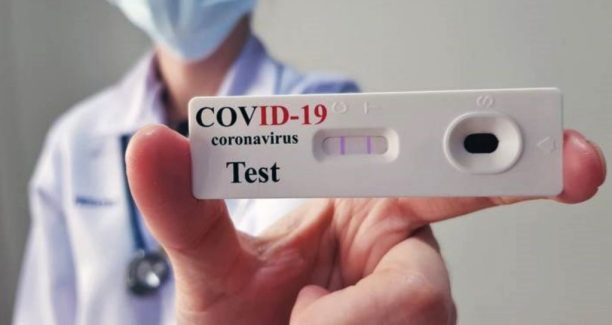 Coronavirus_Covid-19_Test_Sierologico_Rapido_01