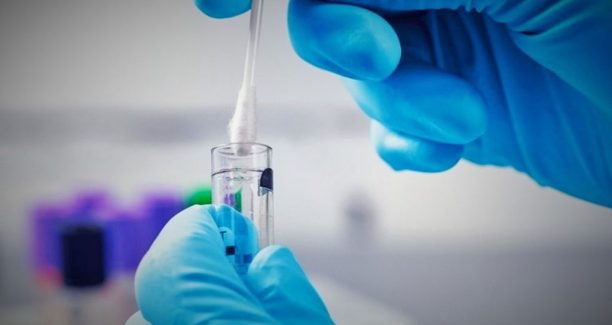 Coronavirus_Tampone_02