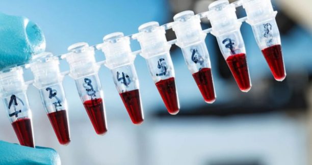 Coronavirus_Test_Seriologici_01