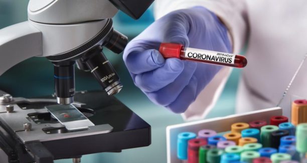 Coronavirus_fialetta_laboratorio_02