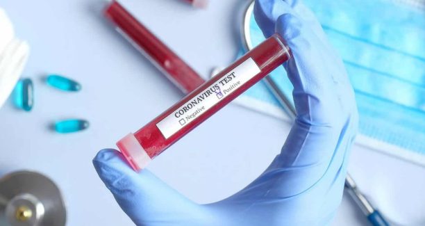 Coronavirus_test_01