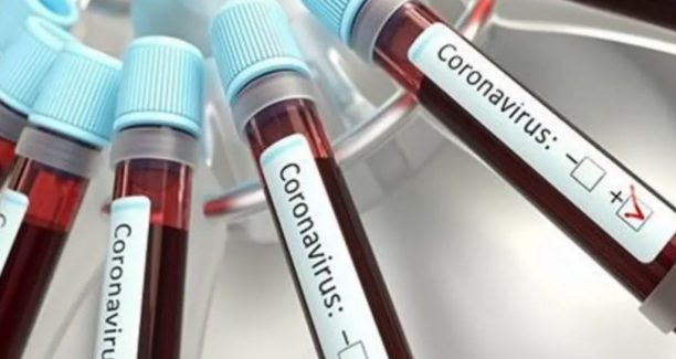 Coronavirus_test_03