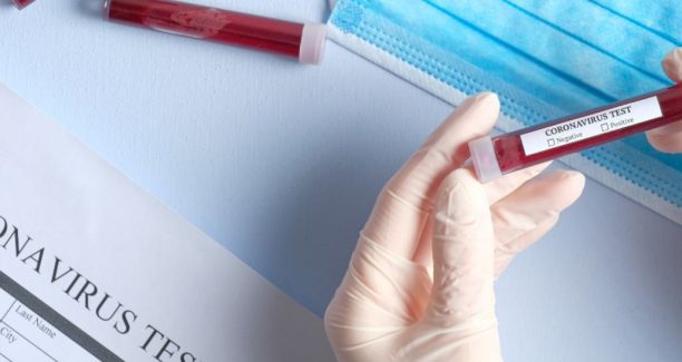 Coronavirus_test_04
