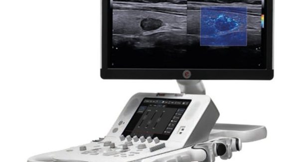 Ecografo_MyLabX8_01